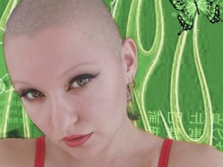 Baldmitzi