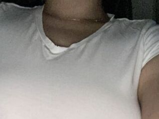 Cachetes