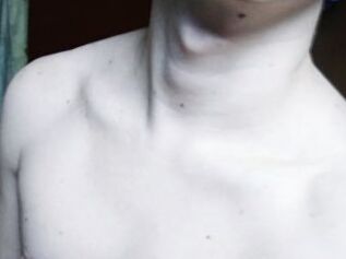 InnoMinnate