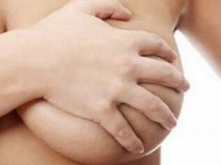 Milk_tits