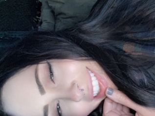 Noraxxo