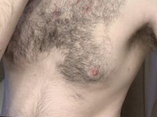 Sexmann