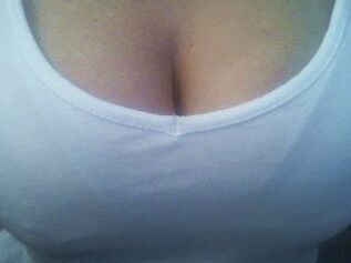 Susy