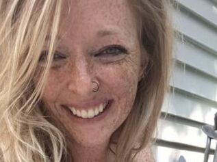 Xfreckledx